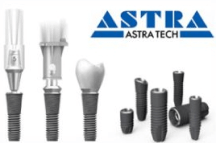 Импланты Astra Tech, (Швеция)