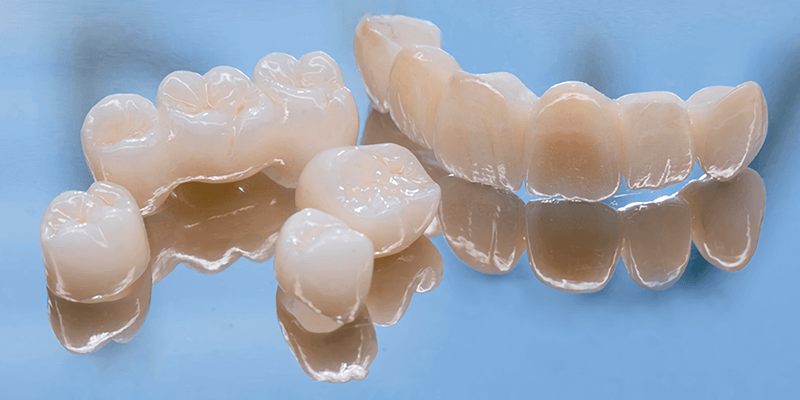 Керамические коронки для зубов