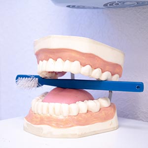 Костная пластика в стоматологии SDent